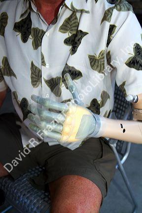 Man with a prosthetic arm in Boise, Idaho, USA. MR