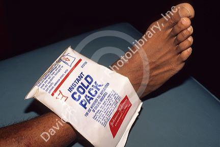Chemical cold pack made of ammonium nitrate.