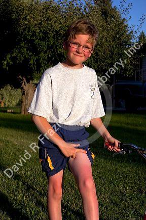Nine year old boy with a sunburn.
