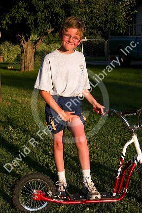 Nine year old boy with a sunburn. MR