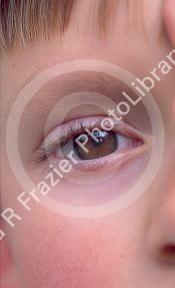 Close up image of a child's eye, eyebrow, eyelid, eyelash.  MR