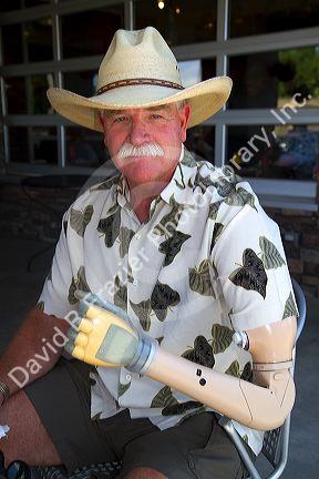 Man with a prosthetic arm in Boise, Idaho, USA. MR
