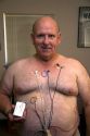 American man wearing a Holter monitor used for monitoring the heart for cardiac arrhythmias. MR