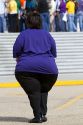 Obese woman.